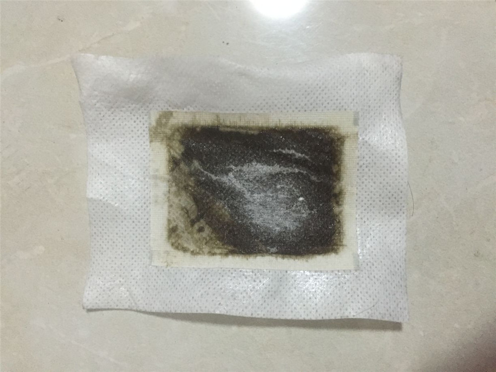 لصقات طبية عالية الجودة لإزالة - مراجعة Detox Foot Patch وسعره